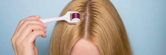 Microneedling para el tratamiento de la caída del cabello