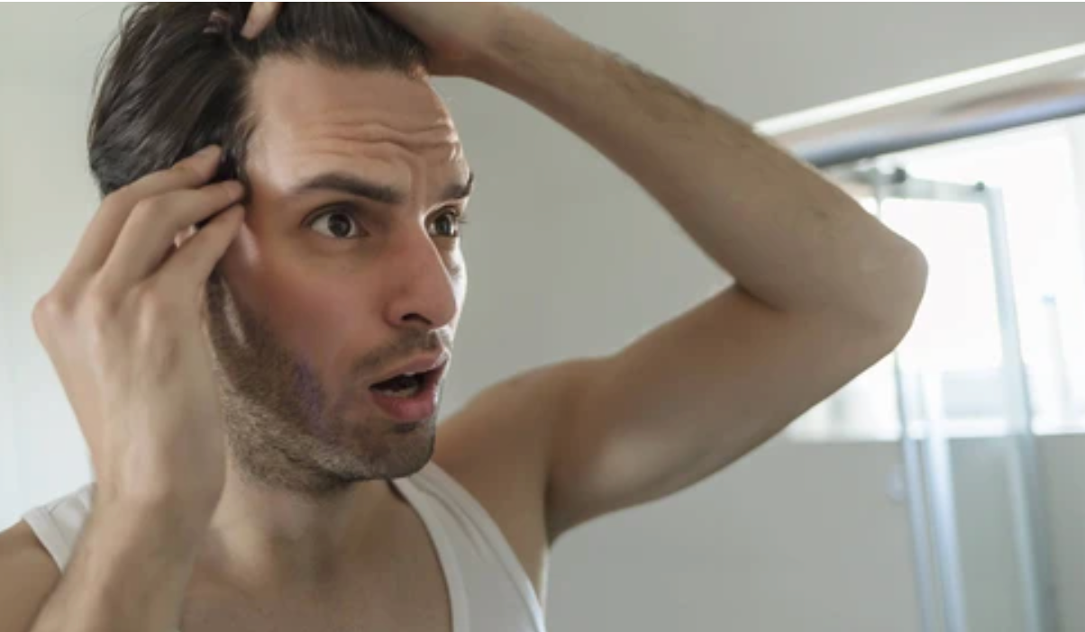 5 cosas que no sabías de la pérdida de cabello