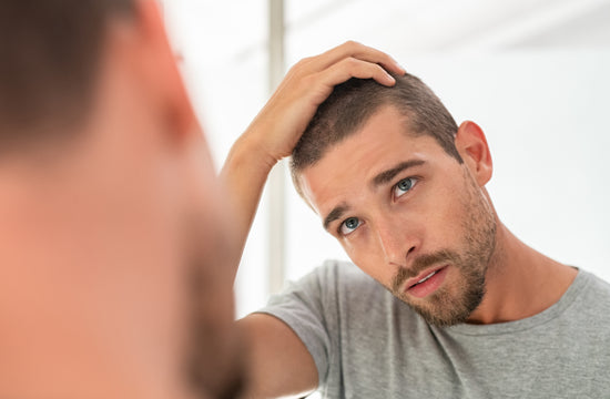 Características principales de los tipos de alopecia en hombres