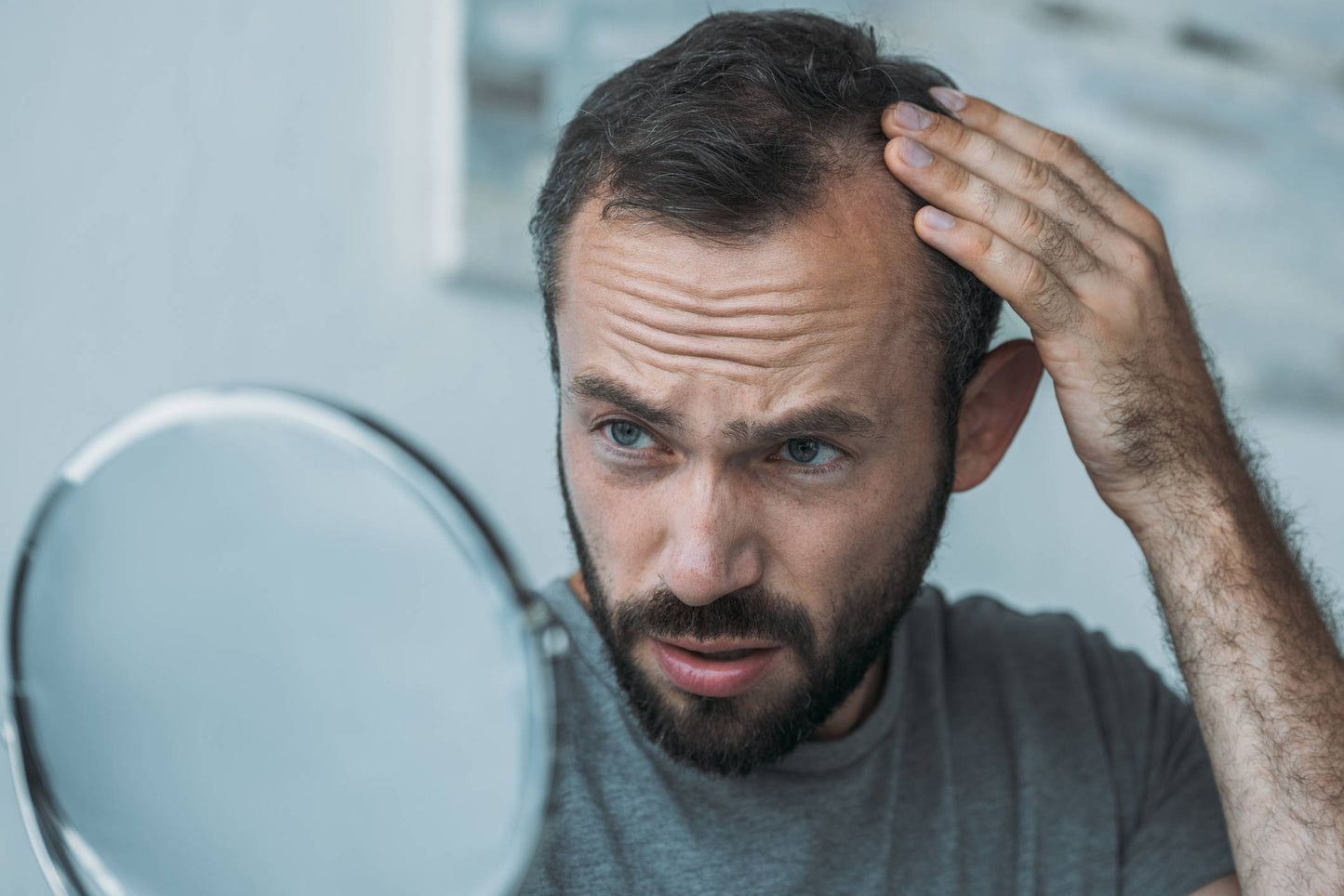 ¿Puede el estrés causar adelgazamiento en el cabello?